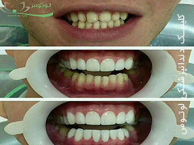 کلینیک دندانپزشکی لوتوس