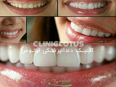 کلینیک دندانپزشکی لوتوس